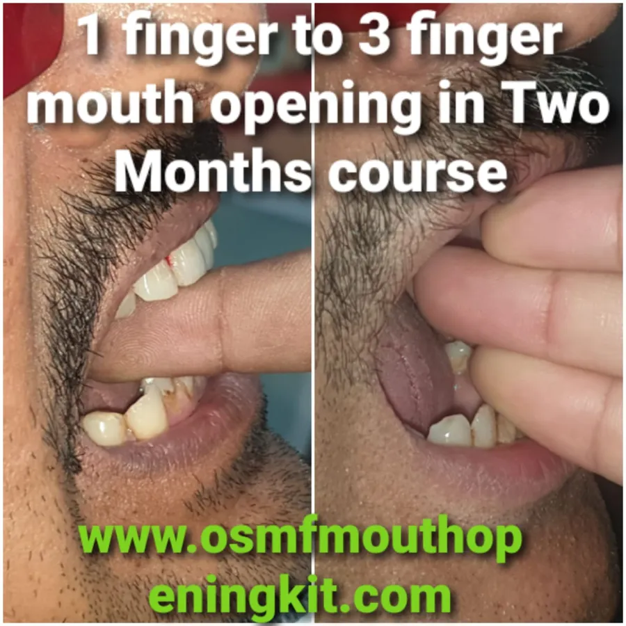 1 finger → 3 fingers – At-home kit · 2 months